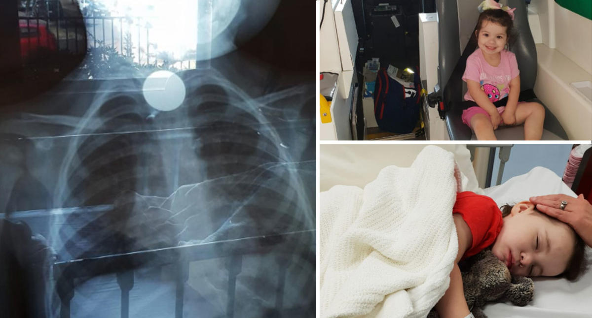 Paramedics save the life of a toddler who swallowed a 10 cent coin