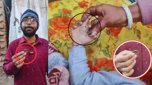 펀자브 아보하르에서 동전 폭발로 유아 부상을 입어 예상치 못한 위험이 부각됨 펀자브 아보하르에서 동전 폭발로 유아 부상을 입어 예상치 못한 위험이 부각됨